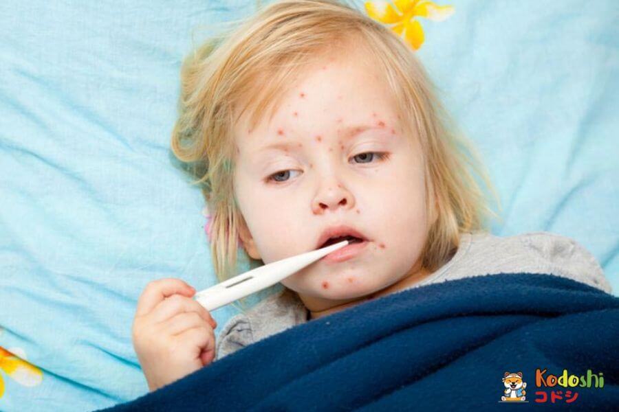 Mẩn đỏ nổi khắp người khi bé bị sốt